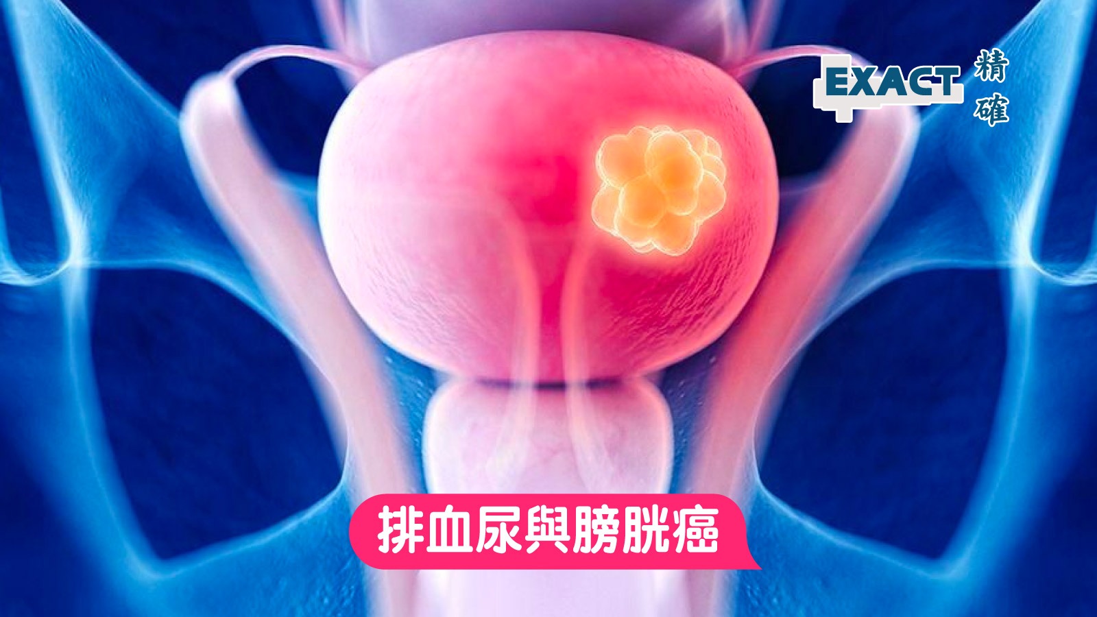 常见膀胱病变的超声表现，多图详解 ！__中国医疗